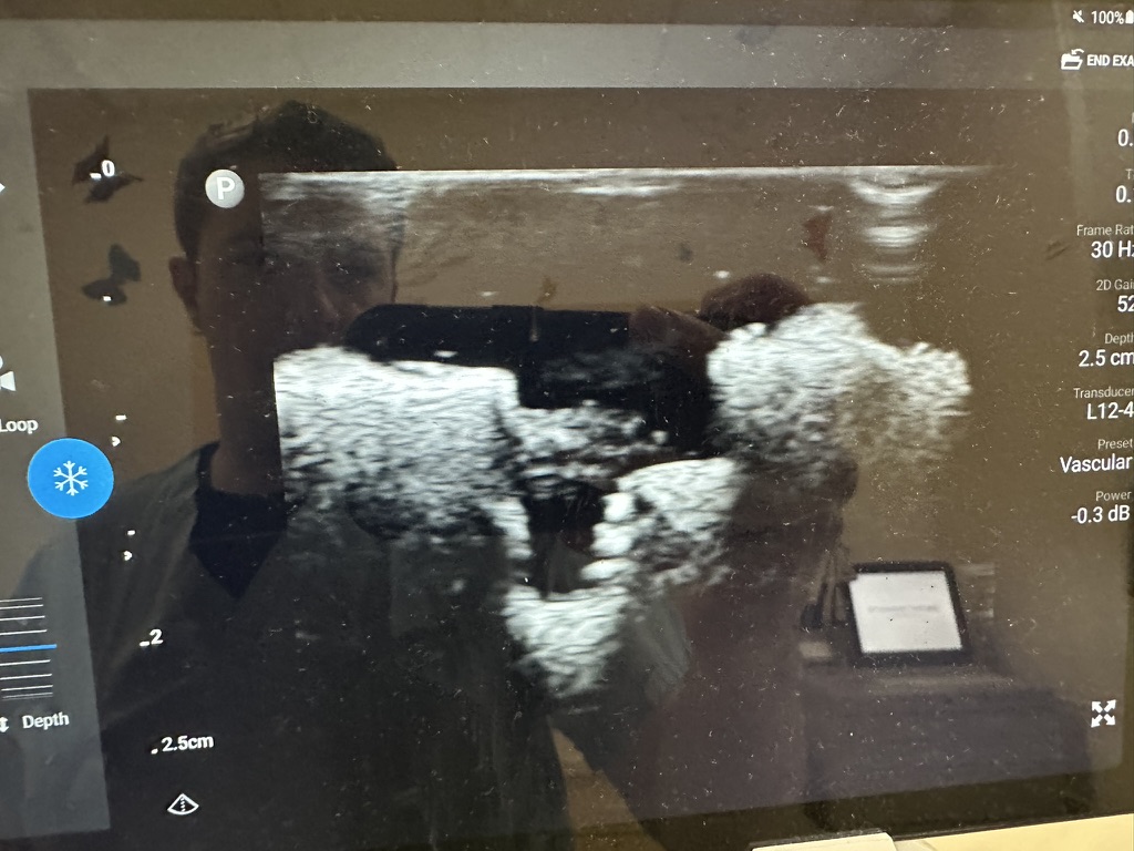 A photo of an ultrasound of a fetus. The head is facing to the left, and the ultrasound is in black and white.