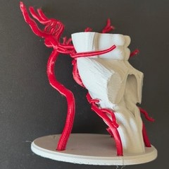 Side profile of a 3D printed diagram of the circle of Willis and the brainstem. The brainstem and the baseplate is printed in white, and from this angle the brainstem is angled backward (into the baseplate), and the muscularity and anatomical details of the brainstem is visible. The circle of Willis is printed in red, and is connected on the back of the brainstem and glued at the baseplate - it looks liek a series of small tubes circling around and up the brainstem. The model is on a black background.