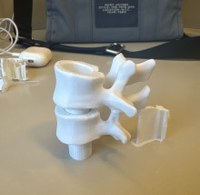 Two 3D printed white vertebrae stacked on top of each other on a beige table. Each vertebra has a hollow center on top and a cylindrical plug on the bottom.